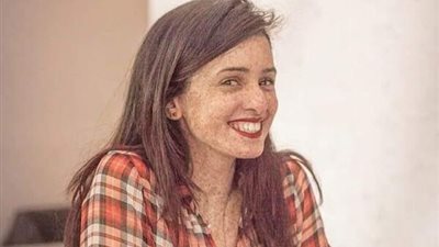 التونسية «لمياء حكيم» حكاية أول امرأة هزمت مرض أطفال القمر وحصلت على الدكتوراة