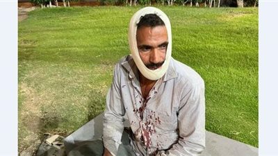 أصيب في وجهه.. شهامة صعيدي تُنقذ سيدة وأطفالها من كلب شرس بالرحاب