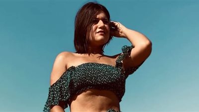 ديانا هشام: تعرضت لحرق بسبب ماء مغلي (صورة)