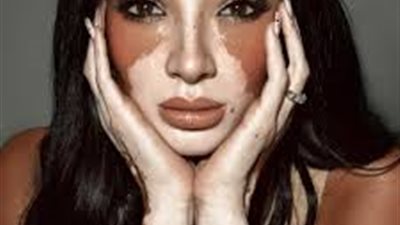 لوجينا صلاح.. مريضة بهاق قهرت التنمر وأصبحت خبيرة تجميل محترفة