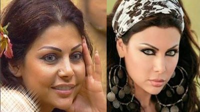 منهن هيفاء ونانسي وأحلام .. 7 فنانات قمن بعمليات تجميل