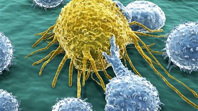 علامات إذا ظهرت على جسدك تشير لإصابتك بالسرطان.. احذريها