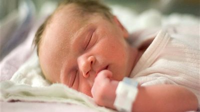 سنة أولى أمومة.. نصائح بسيطة لعلاج الصفراء عند حديثي الولادة