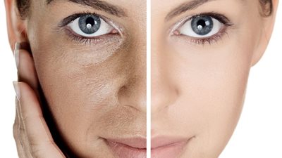 مورد الخدود وأحمر الشفاة.. أستاذ أمراض جلدية يُحذر من أضرار صبغة الخنفساء على البشرة