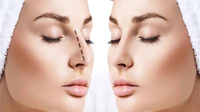 هل عمليات التجميل تبطل عقد الزواج؟.. قانوني يوضح