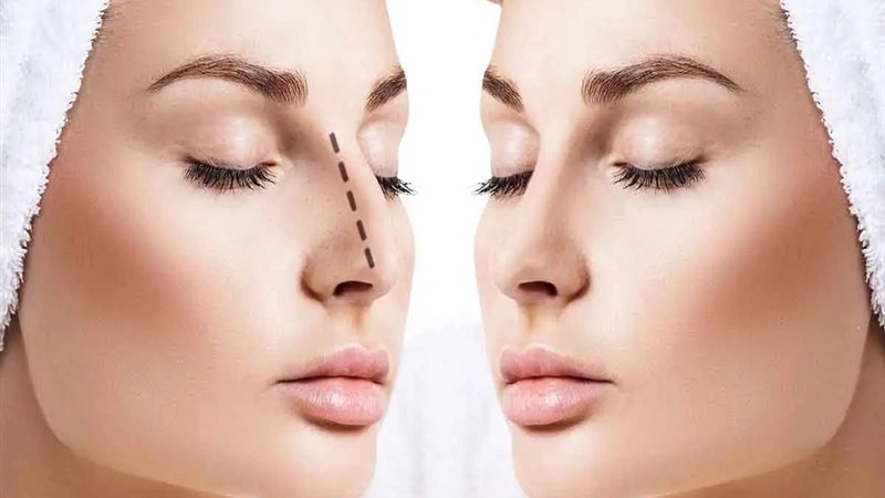 عمليات تجميل