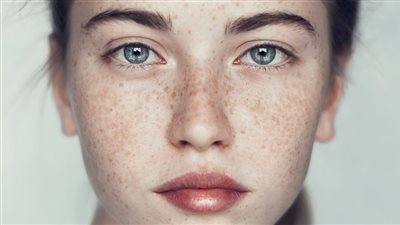 تعرفي على أفضل الأقنعة لإزالة النمش وصفاء البشرة