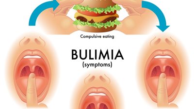 تعرفي على مرض البوليميا.. وما هي أعراضه؟ 