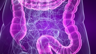 أعراض القولون العصبي عند النساء