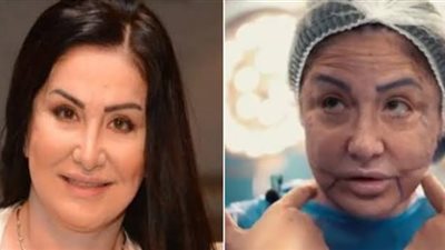 وفاء سالم عن عمليات التجميل: «مكنتش طايقة أبص لنفسي»