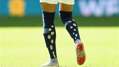 «شرابات مقطعة».. سر ثقوب جوارب اللاعبين في كأس العالم قطر 2022| صور