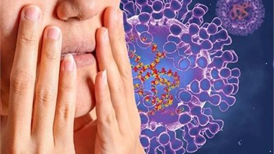 بعد اكتشاف أول حالة إصابة بجدري القردة في مصر.. تعرفي على الأعراض وطرق الوقاية