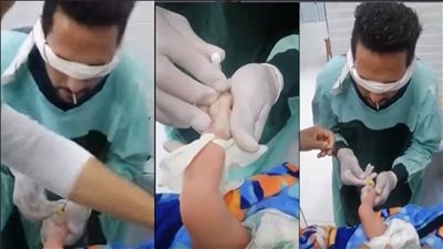  نقيب تمريض المنيا تكشف لـ«هير نيوز» تفاصيل جديدة عن ممرض «الكانيولا»