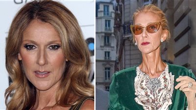 بعد إصابة سيلين ديون بمرض نادر.. تعرفي على أعراضه وأسبابه