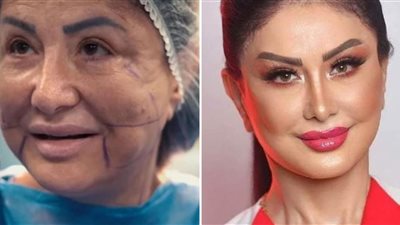 حصاد الفن 2022 | تعرفي على فنانات لجأن إلى عمليات التجميل