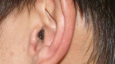 «انتبهي» سماعات الغش تهدد أبناءك بفقدان السمع