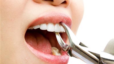 المفتي: يجوز بيع الأسنان المخلوعة في هذه الحالة