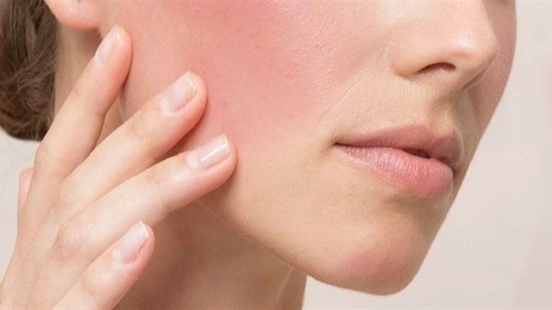 زيت تهدئة البشرة