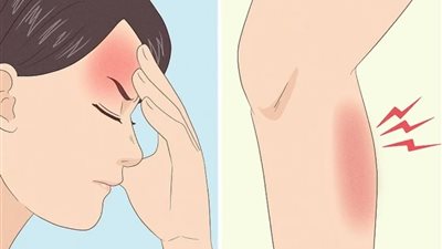 «هل تصيب الرجال؟» تعرفي على أسباب متلازمة الصدمة التسممية