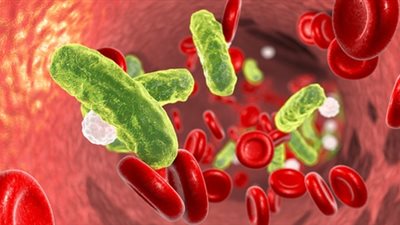 نجاة رضيعة من الموت بسبب «تعفن الدم».. ما القصة؟ 