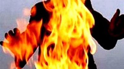 إصابة فتاتين بحروق داخل منزلهما بالبحيرة.. ما القصة؟