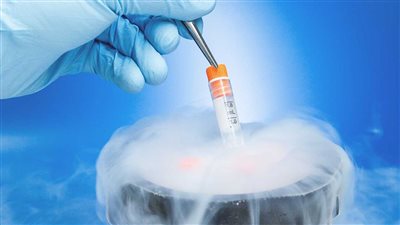 «ماما دوت أم» يناقش تجميد البويضات للمتأخرات في الزواج 