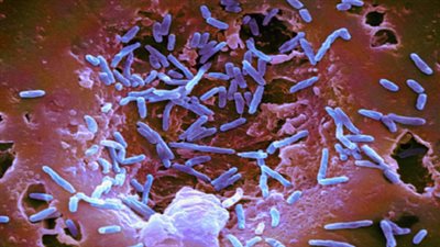 علماء: أنواع من البكتيريا تنقذ العالم وتأكل المواد البلاستيكية