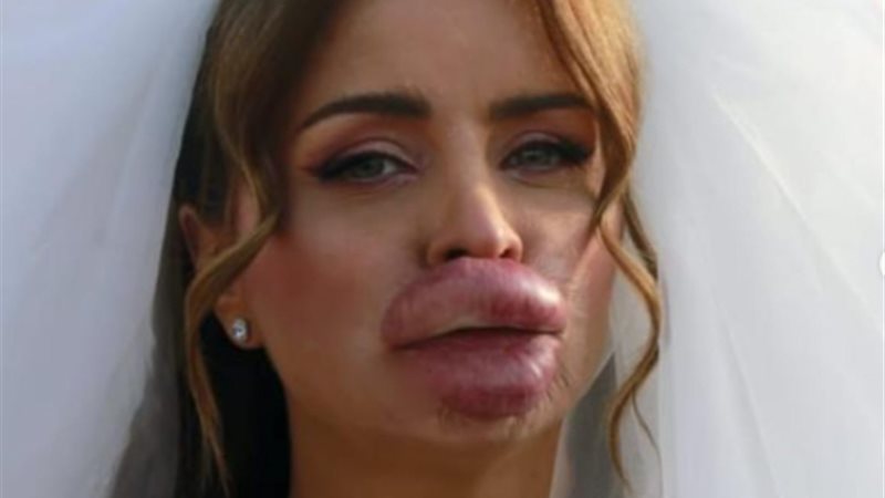 هير نيوز