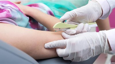 المغرب يدرج شريحة منع الحمل ضمن وسائل تنظيم الأسرة