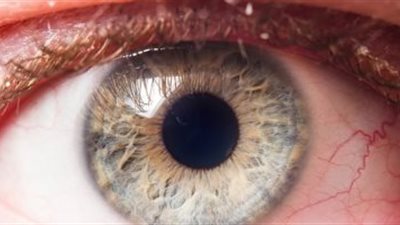 نصائح مهمة للأمهات لإسعاف الأطفال عند إصابة العين