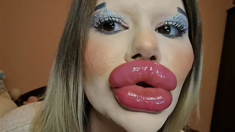 أكبر شفاه في العالم
