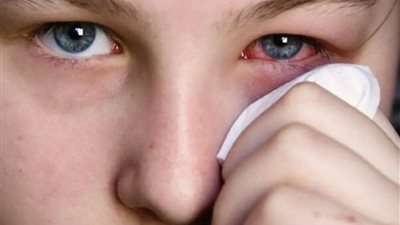 تفسير حلم العين المصابة في المنام وعلاقته بخسارة شخص عزيز