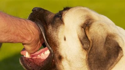 مأساة في القصر العيني| الطفل مات بـ«عضة كلب» والأم هربت