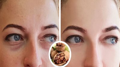 «يعالج الهالات السوداء ويحارب الشيخوخة» عين الجمل طعام خارق لجمال النساء 