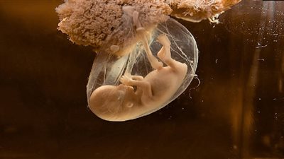 ابتكار نموذج جنين بشري بقلب نابض دون بويضات أو حيوانات منوية