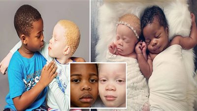 أم تحلم بالأمومة لمدة 10 سنوات وترزق بتوأم أبيض وأسود «صبي أسمر وفتاة شقراء»