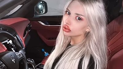 عملية تجميل فاشلة حولت بلوجر روسية إلى مسخ بشري (صور)