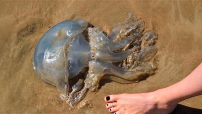 طبيبة جلدية تشرح طريقة علاج لسعة قنديل البحر وتقليل حدة الإصابة