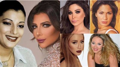 5 فنانات وقعن ضحايا لعمليات التجميل أبرزهن إليسا وأصالة (صور)