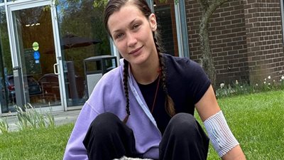 بعد إصابة عارضة الأزياء بيلا حديد.. ما هو مرض لايم؟ 