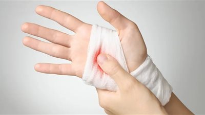 سيدة مطلقة: رأيت يدي مجروحة وتنزف في المنام فما تفسير الحلم؟