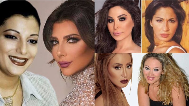 عمليات تجميل النجمات