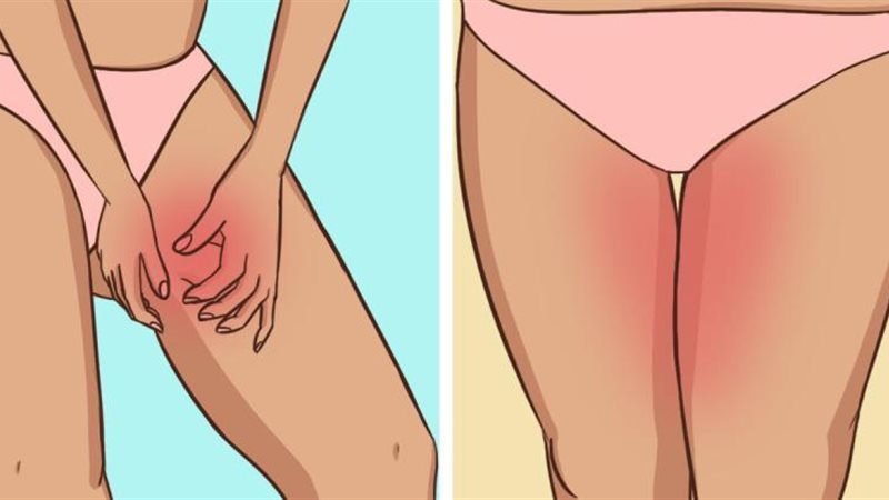 تفتيح منطقة البكيني