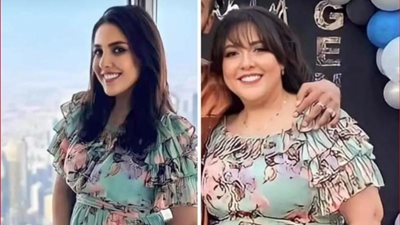 تفاصيل عملية تكميم المعدة بالمنظار بدون جراحة