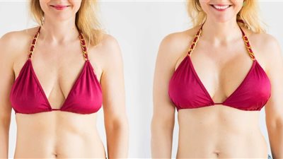 3 طرق لحل مشاكل ترهلات الثدي «خلطات من خير الطبيعة»