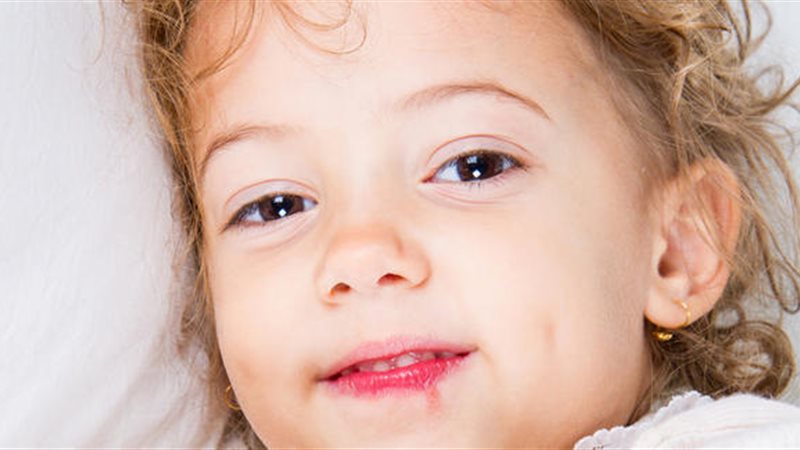 الهربس عند الأطفال