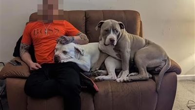 كلب يهاجم شاب بريطاني بوحشية بعد دفاعه عن والدته ضد الهجوم الشرس