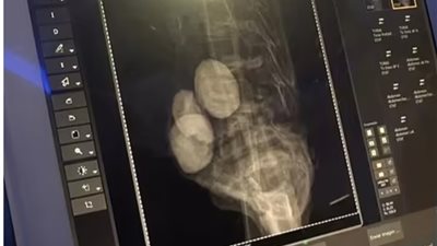 طبيب مكسيكي يكشف حقائق صادمة عن الأجسام الفضائية بعد عرضها أمام الكونجرس