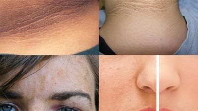 4 وصفات تبييض الرقبة من مطبخك «من غير فلوس»