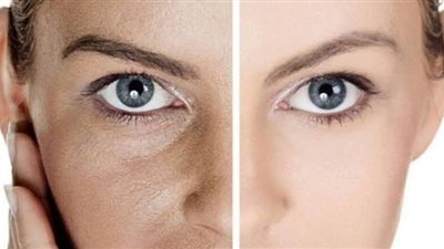 كيفية التخلص من الإسمرار بسبب الشمس | 4 طرق سحرية